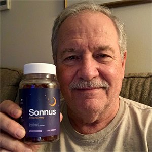 Sonnus customer